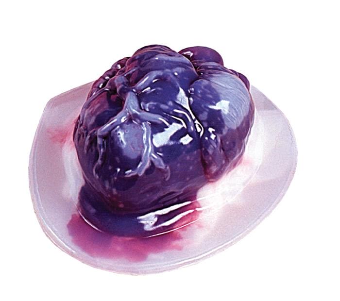 Heart Gelatin Mold